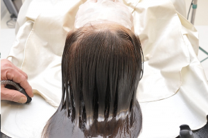 scalp micropigmentation training